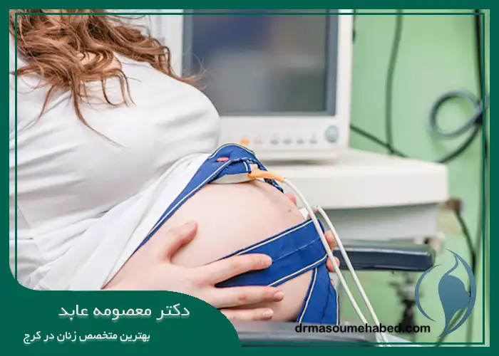 تست NST در بارداری در کرج