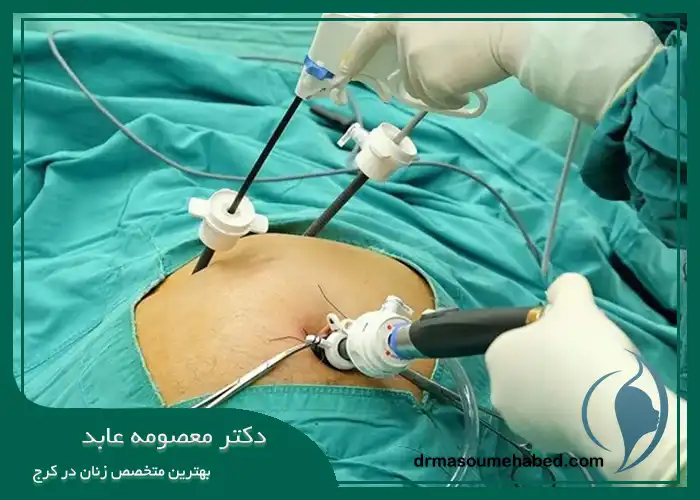 کاندید عمل برداشتن رحم