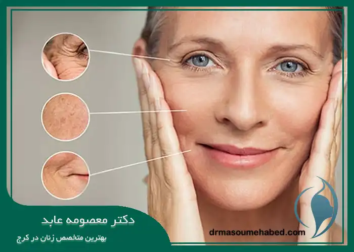 هزینه کربوکسی تراپی در کرج