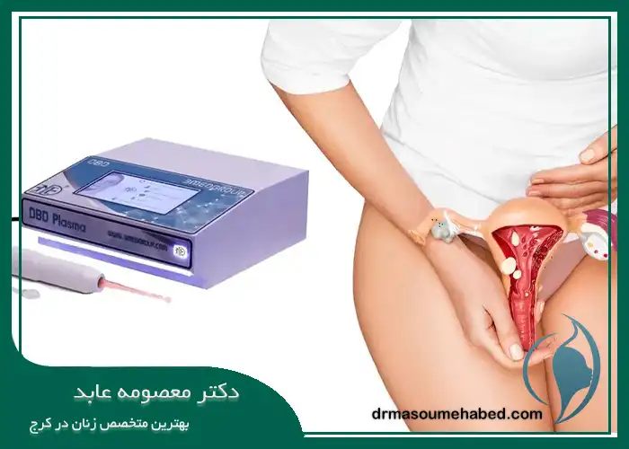 محدودیت ‌های DBD پلاسما در کرج