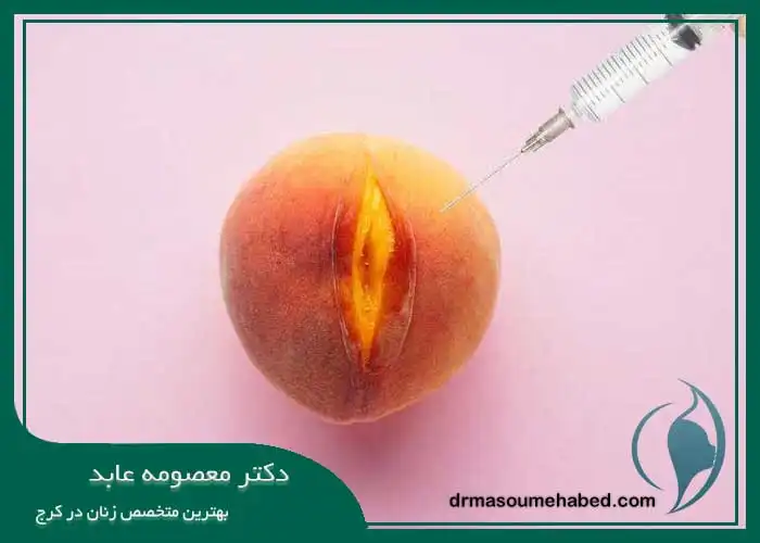 درمان تزریق ژل به بیکینی در کرج