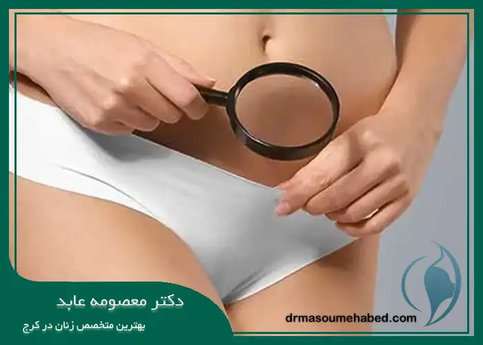 چه کسانی کاندیدای مناسبی برای هودکتومی در کرج هستند؟