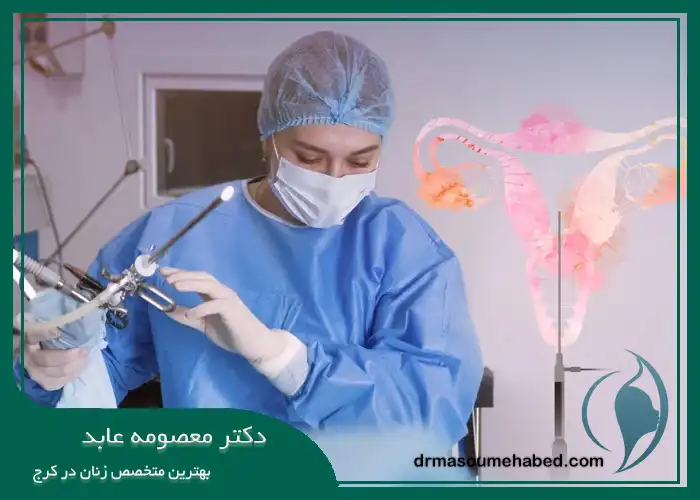 مراحل انجام هیستروسکوپی رحم در کرج