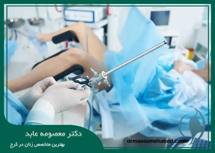 هیستروسکوپی رحم