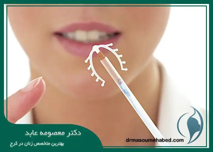 تعبیه IUD در کرج