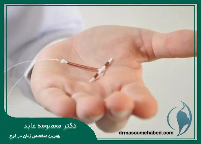 مزایای آی یو دی