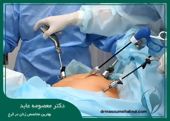 مراحل انجام جراحی لاپاراسکوپی کیست تخمدان در کرج