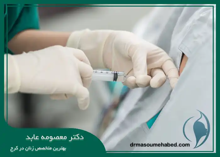 مزایای زایمان بدون درد با اپیدورال