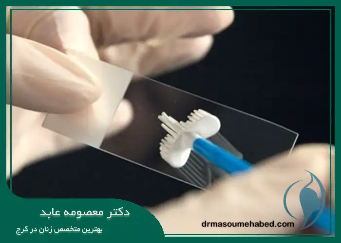 مدت زمان تست پاپ اسمیر در کرج