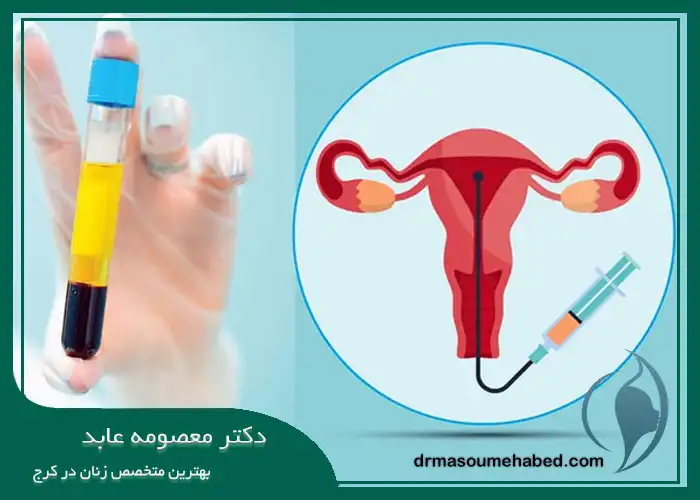 مراقبت‌ های بعد از پی آر پی واژن