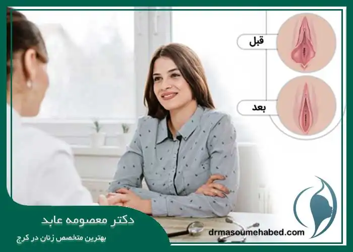 لابیاپلاستی با لیزر