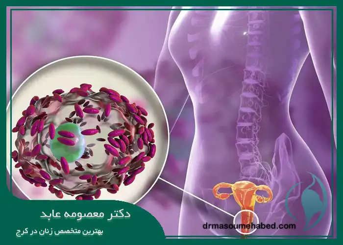 عفونت واژن ناشی از باکتری