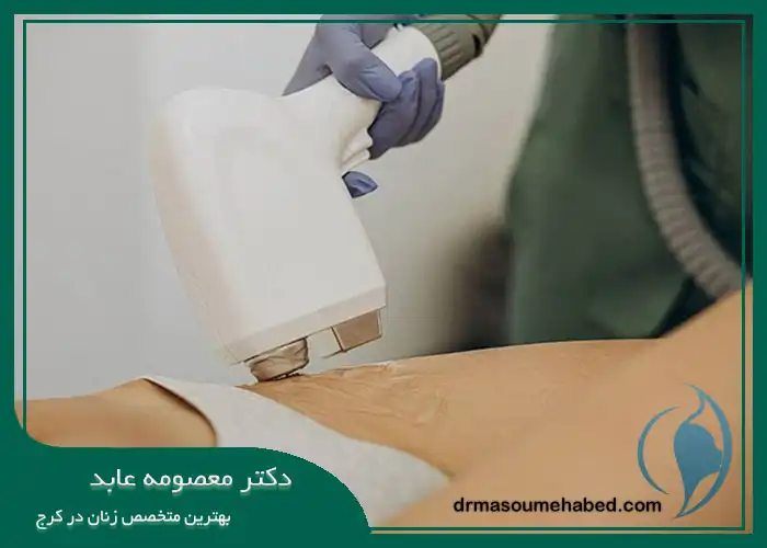 بلیچینگ واژن
