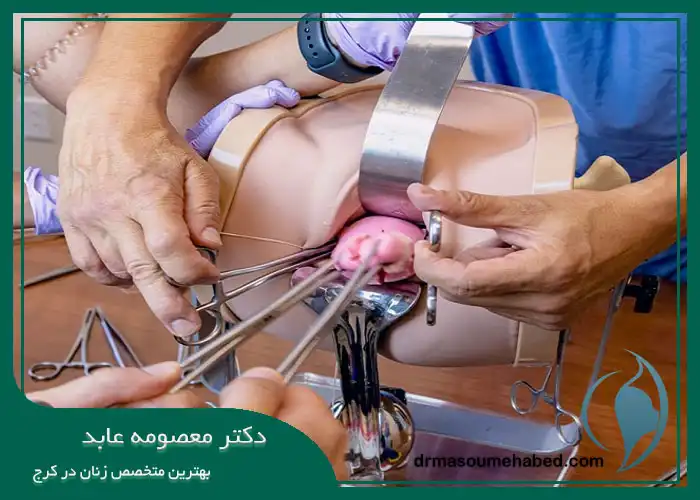 هیسترکتومی واژینال در کرج