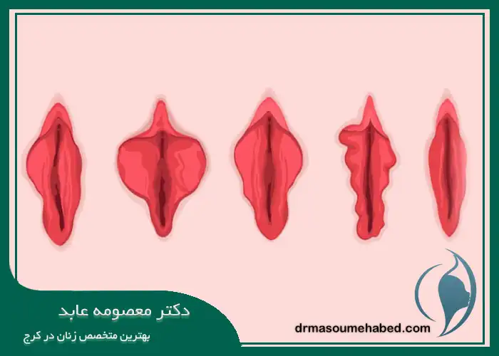 ظاهر لابیاها