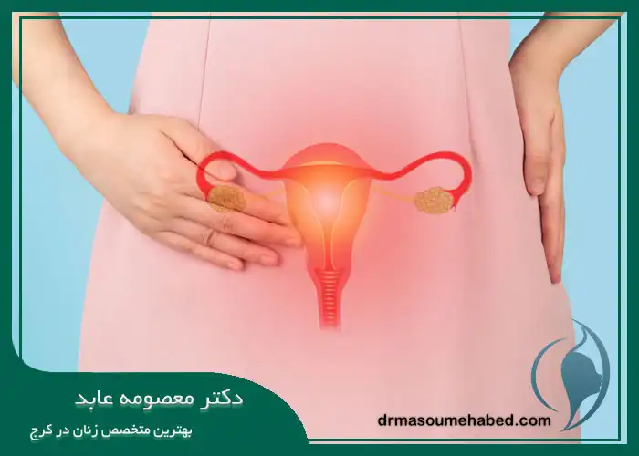 دلایل اصلی انجام هیسترکتومی ابدومینال