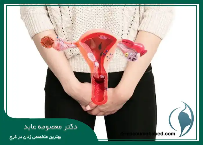 عوارض هیستروسکوپی
