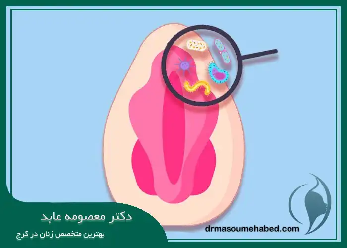 عفونت بعد از لابیاپلاستی