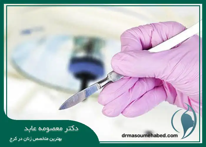 دلایل اصلی برای جراحی ترمیمی لابیاپلاستی