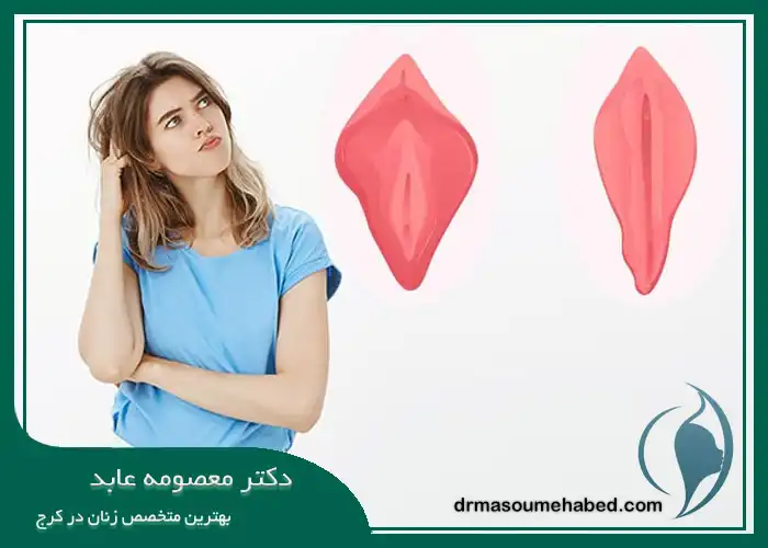 انتخاب میان روش جراحی یا لیزر برای لابیاپلاستی