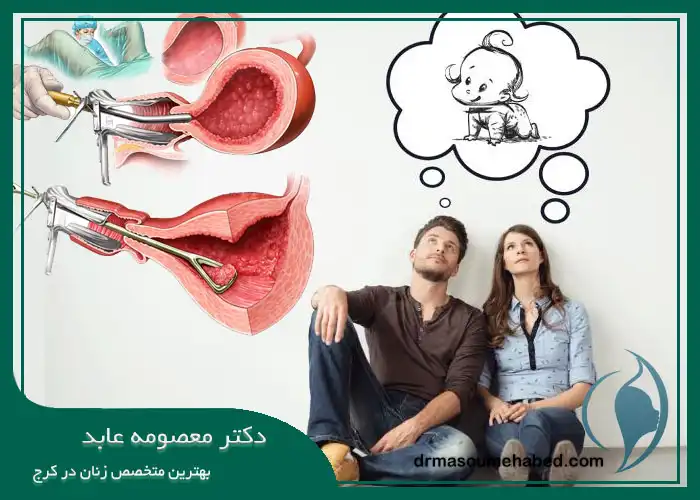 بهترین زمان برای بارداری بعد از هیستروسکوپی