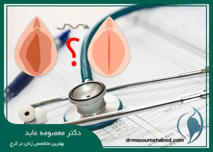 معرفی آزمایشات قبل لابیاپلاستی