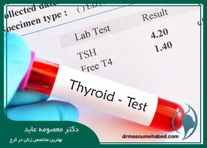 آزمایش تیروئید