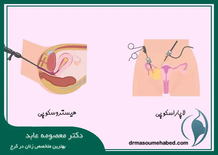 فرق بین هیستروسکوپی و لاپاراسکوپی