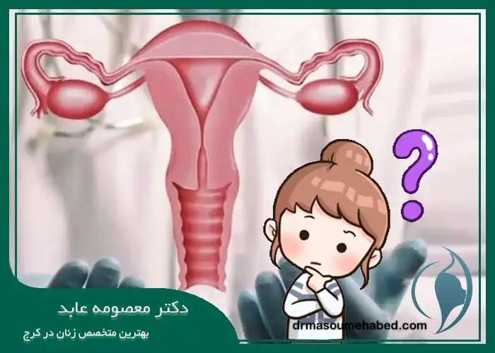 سوالات متداول هیسترکتومی
