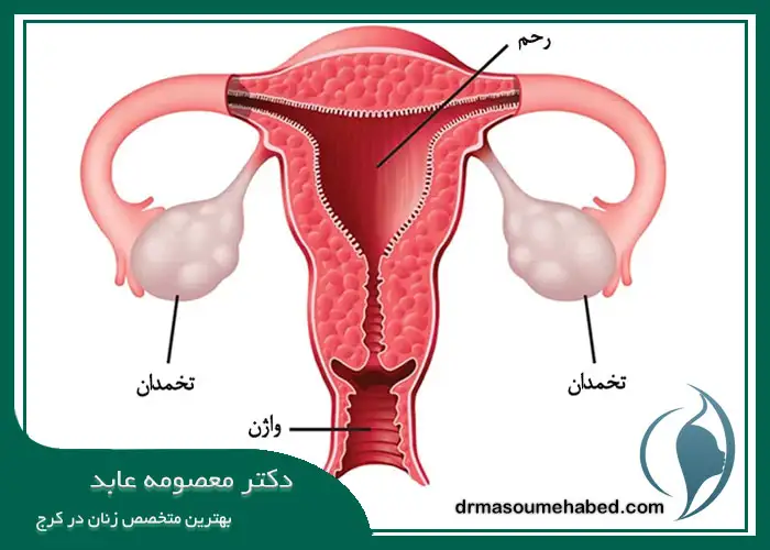 نگه داشتن تخمدان‌ ها