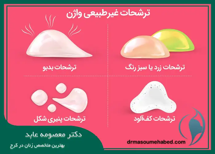 درمان ترشحات غیرطبیعی واژن در کرج