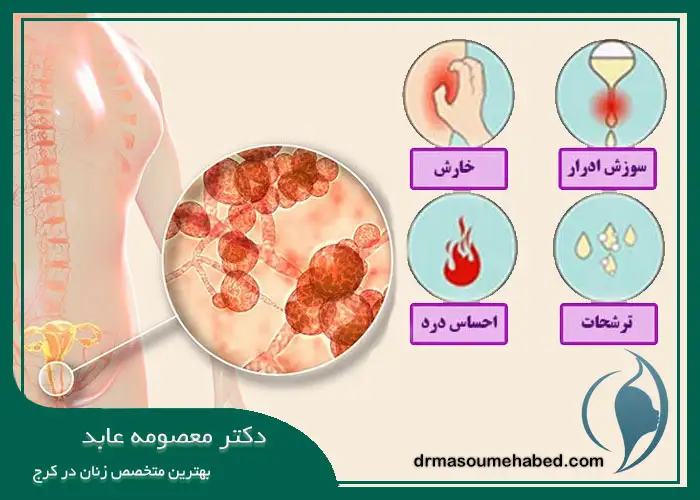 متخصص زنان خوب برای درمان عفونت واژن در کرج