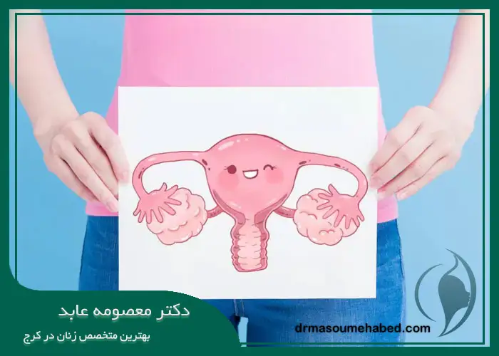 پیشگیری از کیست تخمدان