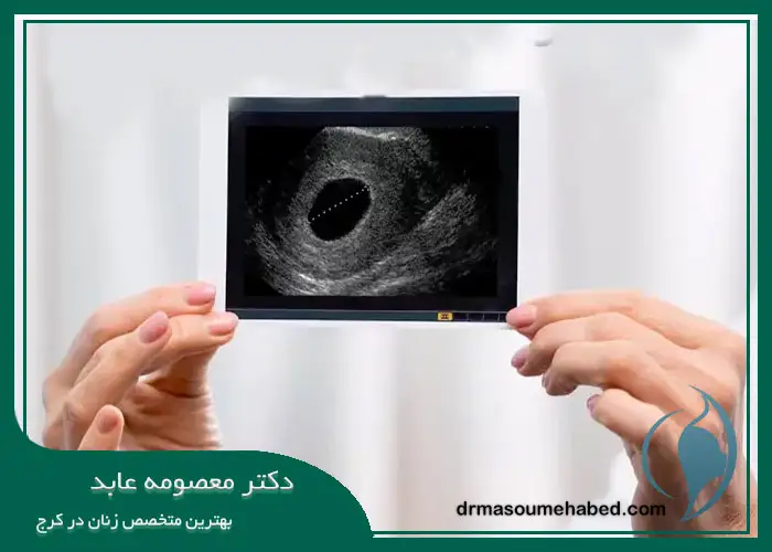 چه بانوانی دچار بارداری پوچ می‌شوند؟