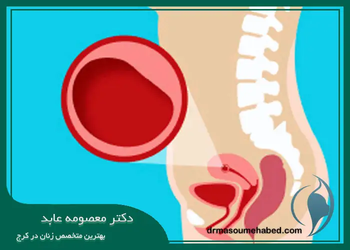مراقبت‌های پس از درمان بارداری پوچ