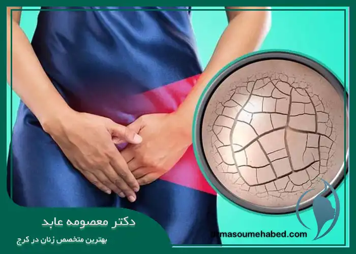 چه زمانی برای درمان خشکی واژن به متخصص در کرج مراجعه کنیم؟